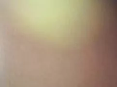 Quốc hồng mủ phim se ...